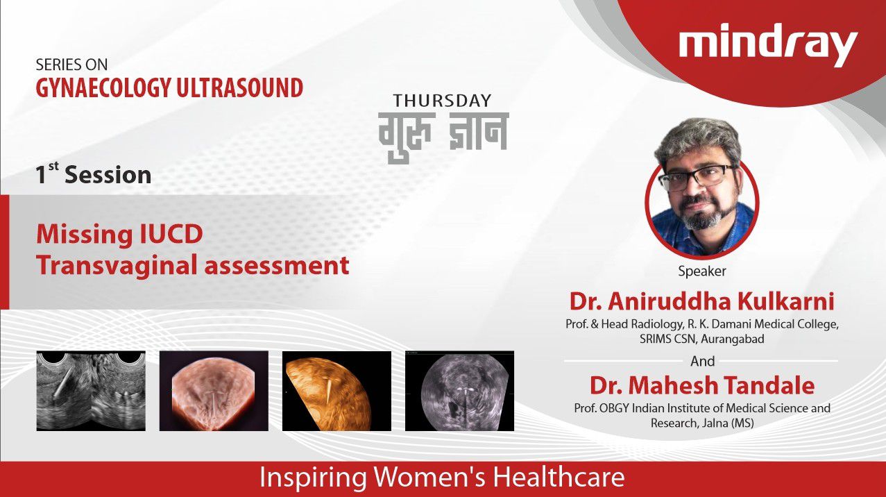 Session 1 Thumbnail - Without Time